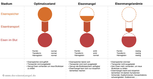 Vom Eisenmangel bis hin zur Eisenmangelanämie